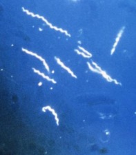Morgellons - Hallelujah treatment