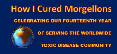 Morgellons - <form action="https://www.paypal.com/cgi-bin/webscr" meth	od="post" target="_top"><input type="hidden" name="cmd" value="_s-xclick"><input type="hidden" name="hosted_button_id" value="DZCVBAWQY7LY8"><input type="image" src="https://www.paypalobjects.com/en_US/i/btn/btn_donateCC_LG.gif" border="0" name="submit" alt="PayPal - The safer, easier way to pay online!"><img alt="" border="0" src="https://www.paypalobjects.com/en_US/i/scr/pixel.gif" width="1" height="1"></form>