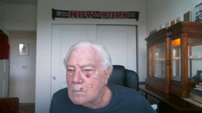 Morgellons - Just The Beginning