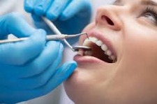 Morgellons - Dental Care