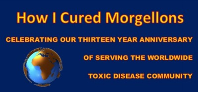 Morgellons - <form action="https://www.paypal.com/cgi-bin/webscr" meth	od="post" target="_top"><input type="hidden" name="cmd" value="_s-xclick"><input type="hidden" name="hosted_button_id" value="DZCVBAWQY7LY8"><input type="image" src="https://www.paypalobjects.com/en_US/i/btn/btn_donateCC_LG.gif" border="0" name="submit" alt="PayPal - The safer, easier way to pay online!"><img alt="" border="0" src="https://www.paypalobjects.com/en_US/i/scr/pixel.gif" width="1" height="1"></form>